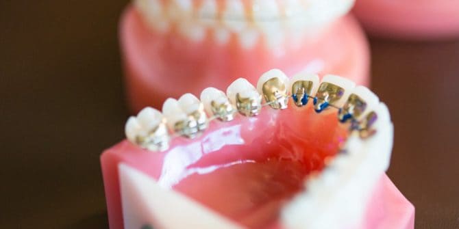 Fergus Orthodontics Jonesboro Arkansas General Shots 156 670x335 - Technology and Treatment for Orthodontics and Braces in Jonesboro Arkansas