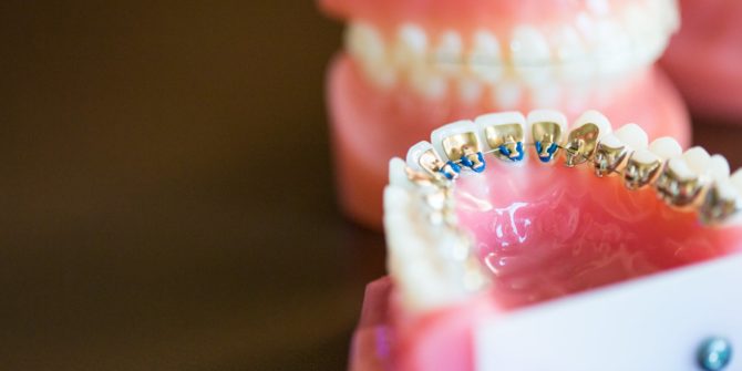 Fergus Orthodontics Jonesboro Arkansas General Shots 158 670x335 - Technology and Treatment for Orthodontics and Braces in Jonesboro Arkansas