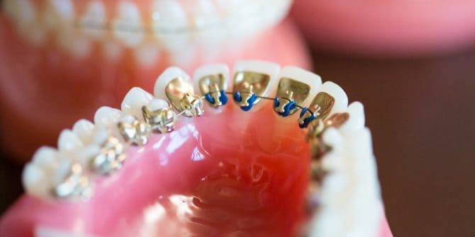 Fergus Orthodontics Jonesboro Arkansas General Shots 163 670x335 - Technology and Treatment for Orthodontics and Braces in Jonesboro Arkansas