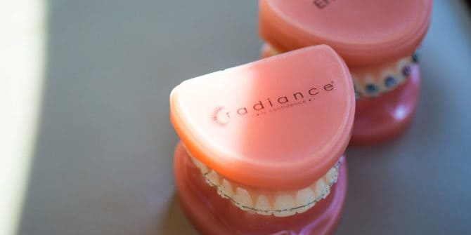Fergus Orthodontics Jonesboro Arkansas General Shots 168 670x335 - Clear Braces