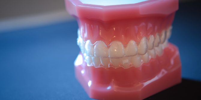 Fergus Orthodontics Jonesboro Arkansas Invisalign 1 of 4 670x335 - Invisalign & Invisalign Teen