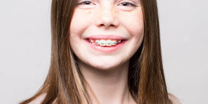 Fergus Orthodontics Jonesboro Arkansas Patient Portraits 38 670x335 - Our Beautiful Smiles