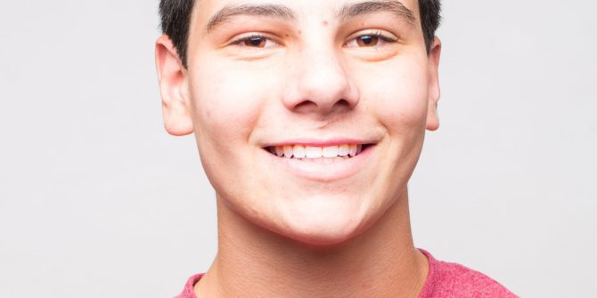 Fergus Orthodontics Jonesboro Arkansas Patient Portraits 39 670x335 - Our Beautiful Smiles